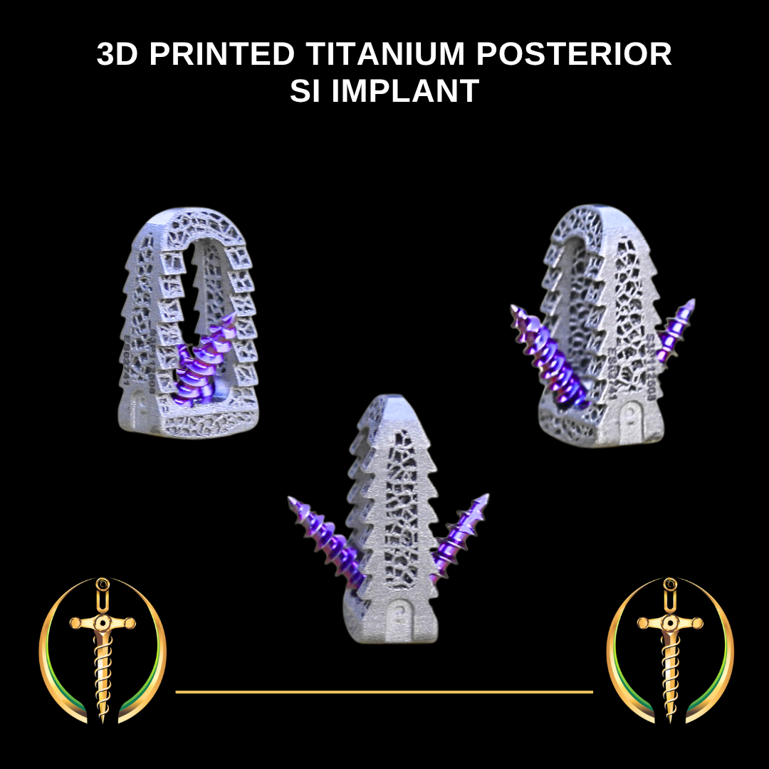 Eminent Spine’s 3D Printed Titanium Posterior SI System Receives FDA 510(k) Clearance